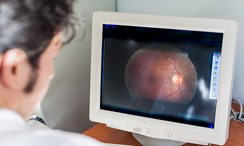 Retinal Vein Occlusion