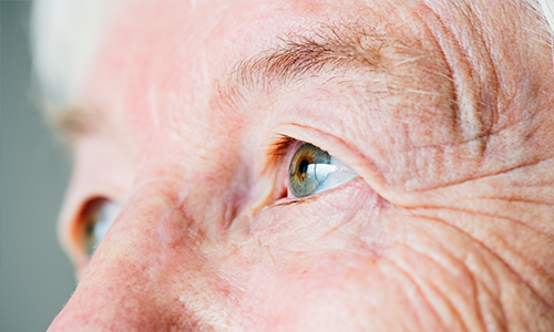 eyeconditions